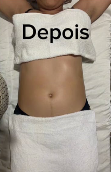 Depois